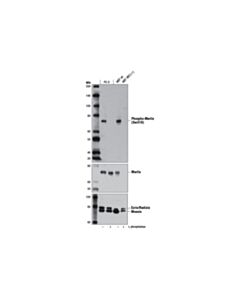 Cell Signaling Phospho-Merlin (Ser518) (D5a4i) Rabbit mAb