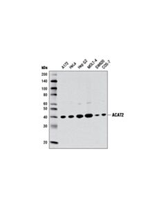 Cell Signaling Acat2 (E1l8v) Rabbit mAb