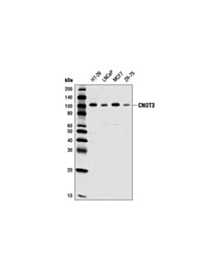 Cell Signaling Cnot3 (E1l9s) Rabbit mAb