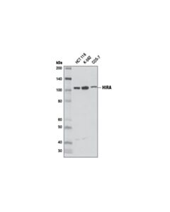 Cell Signaling Hira (D2a5e) Rabbit mAb