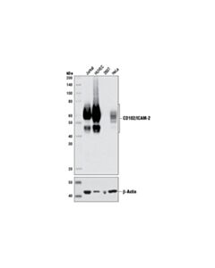 Cell Signaling CD102/ICAM-2 (D7P2Q) Rabbit mAb 20 uL