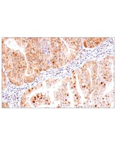 Cell Signaling ATP-Citrate Lyase (D1x6p) Rabbit mAb