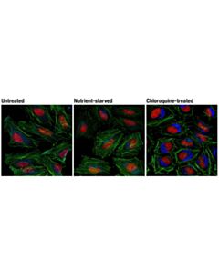 Cell Signaling Lc3a/B (D3u4c) Xp Rabbit mAb (Alexa Fluor 647 Conjugate)