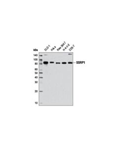 Cell Signaling Ssrp1 (E1y8d) Rabbit mAb