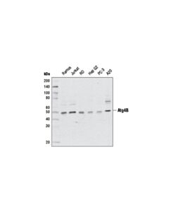 Cell Signaling Atg4b (D1g2r) Rabbit mAb