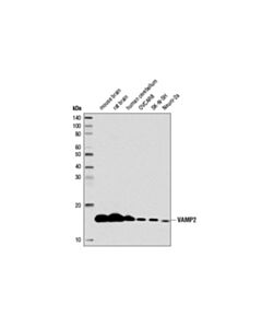 Cell Signaling Vamp2 (D6o1a) Rabbit mAb