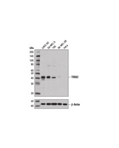 Cell Signaling Trib2 (D8p2x) Rabbit mAb