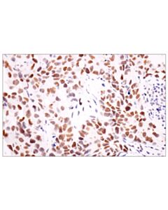 Cell Signaling Acetyl-Histone H4 (Lys16) (E2b8w) Rabbit mAb