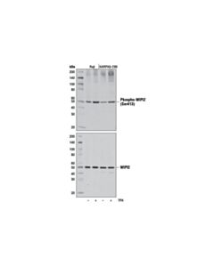 Cell Signaling Phospho-Wipi2 (Ser413) Antibody