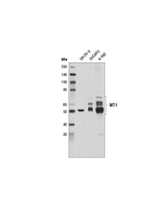 Cell Signaling WT1 (D6M6S) Rabbit mAb 20 uL