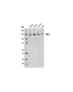 Cell Signaling Rbl2 (D9t7m) Rabbit mAb