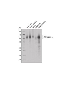 Cell Signaling Dag Lipase Alpha (D3g8h) Rabbit mAb