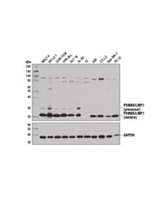 Cell Signaling Psmb8/Lmp7 (D1k7x) Rabbit mAb