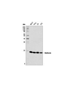 Cell Signaling Stathmin (D1y5a) Rabbit mAb