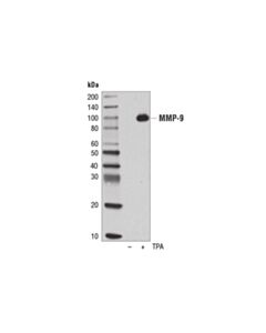 Cell Signaling Mmp-9 (D6o3h) Xp<LT/>Sup&Gt;®<LT/>/Sup&Gt; Rabbit mAb
