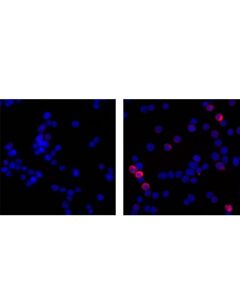 Cell Signaling Phospho-HS1 (Tyr397) (D12; CSIG-13708S