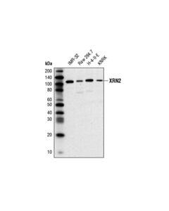 Cell Signaling Xrn2 (D6l5f) Rabbit mAb