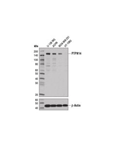 Cell Signaling PTPN14 (D5T6Y) Rabbit mAb 20 uL