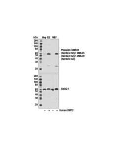 Cell Signaling Phospho-SMAD1 (Ser463/465)/ SMAD5 (Ser463/465)/ SMAD9 (Ser465/467) (D5B10) Rabbit Monoclonal Antibody