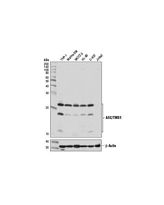 Cell Signaling ASC/TMS1 (E1E3I) Rabbit mAb 20 uL