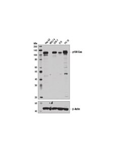 Cell Signaling p130 Cas (E1L9H) Rabbit mAb 20 uL