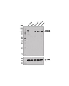 Cell Signaling Unc5b (D9m7z) Rabbit mAb