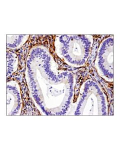 Cell Signaling Galectin-1/Lgals1 (D608t) Rabbit mAb (Ihc Formulated)