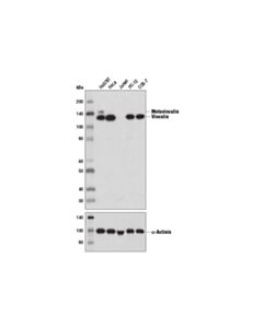 Cell Signaling Vinculin (E1e9v) Xp<LT/>Sup&Gt;®<LT/>/Sup&Gt; Rabbit mAb
