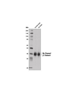 Cell Signaling Na Channel beta1 Subunit (D4Z2N) Rabbit mAb 20 uL