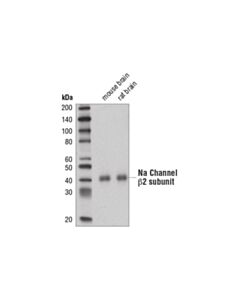Cell Signaling Na Channel Beta2 Subunit (D6l5y) Rabbit mAb