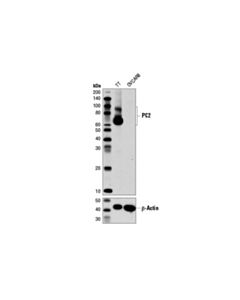 Cell Signaling Pc2 (D1e1s) Xp Rabbit mAb