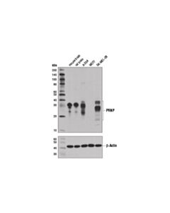Cell Signaling Prnp (D3q5c) Rabbit mAb