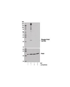 Cell Signaling Phospho-Prdx1 (Tyr194) (D1t9c) Rabbit mAb