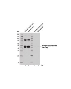 Cell Signaling Phospho-Doublecortin (Ser334) (D11b10) Rabbit mAb
