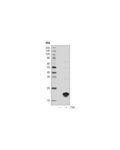 Cell Signaling Acetyl-Histone H3 (Lys27) (D5e4) Xp  Rabbit mAb (Hrp Conjugate)
