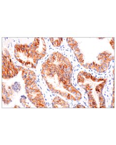 Cell Signaling B7-H3 (D9m2l) Xp Rabbit mAb