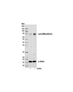 Cell Signaling Lyric/Metadherin (D5y8r) Xp Rabbit mAb
