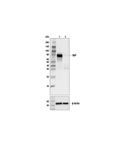 Cell Signaling Yap (D8h1x) Xp<LT/>Sup&Gt;®<LT/>/Sup&Gt; Rabbit mAb