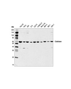 Cell Signaling Catalase (D5n7v) Rabbit mAb