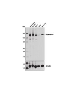 Cell Signaling Spinophilin (E1e7r) Rabbit mAb