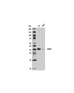 Cell Signaling Eaf2 (E1r8c) Rabbit mAb