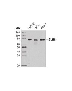 Cell Signaling Coilin (D2l3j) Xp Rabbit mAb