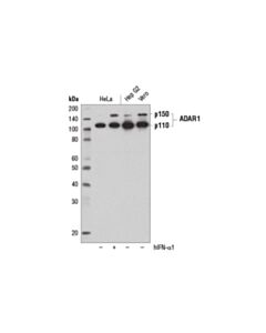 Cell Signaling Adar1 (D7e2m) Rabbit mAb