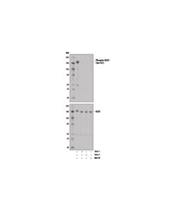 Cell Signaling Phospho-Ulk1 (Ser757) (D7o6u) Rabbit mAb