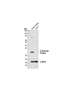 Cell Signaling C-Reactive Protein (D1n1u) Rabbit mAb