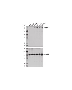 Cell Signaling Topbp1 (D8g4l) Rabbit mAb
