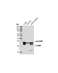 Cell Signaling Comt (D4n6m) Rabbit mAb