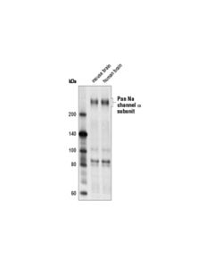 Cell Signaling Pan Na Channel Alpha Subunit (D2i9c) Rabbit mAb
