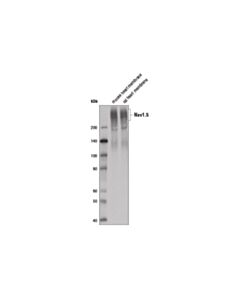 Cell Signaling Nav1.5 (D9j7s) Rabbit mAb