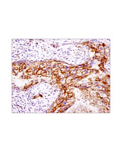 Cell Signaling EpCAM (D9S3P) Rabbit mAb